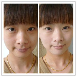 皮肤暗沉对比图