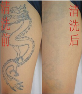 洗纹身