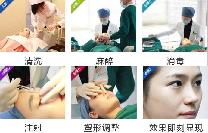 【暑期整形比较强攻略】如何以比较小的代价，获得比较高的颜值？