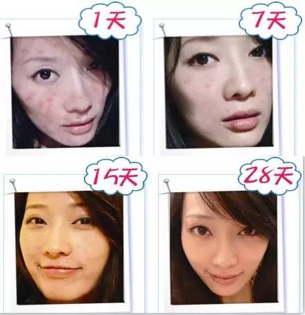 【暑期整形比较强攻略】如何以比较小的代价，获得比较高的颜值？