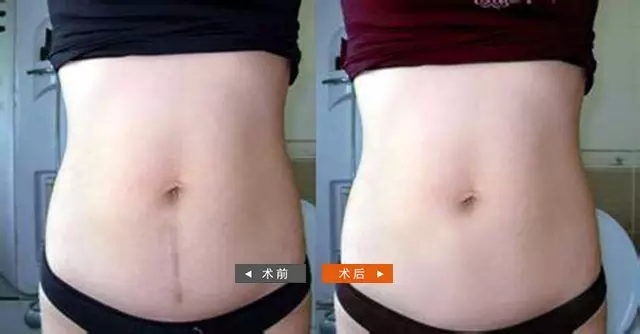 案例