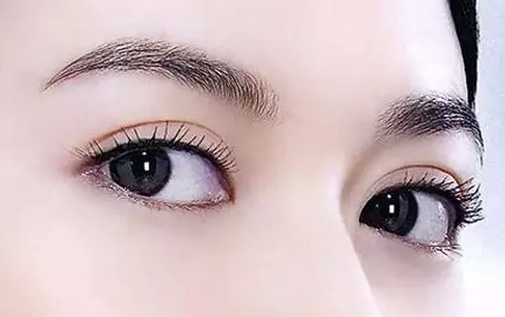 双眼皮+开眼角一块做，大眼加倍!