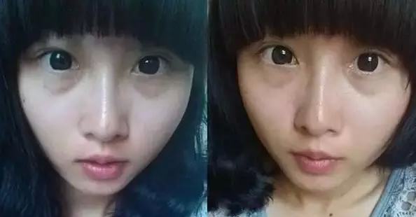 一条眼袋老十岁，你还敢留吗