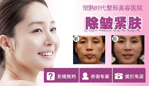 除皱,嫩肤,时代除皱